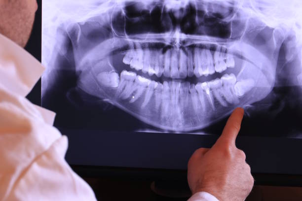 Best Emergency Dental Care for Broken or Chipped Teeth in Lawton, OK